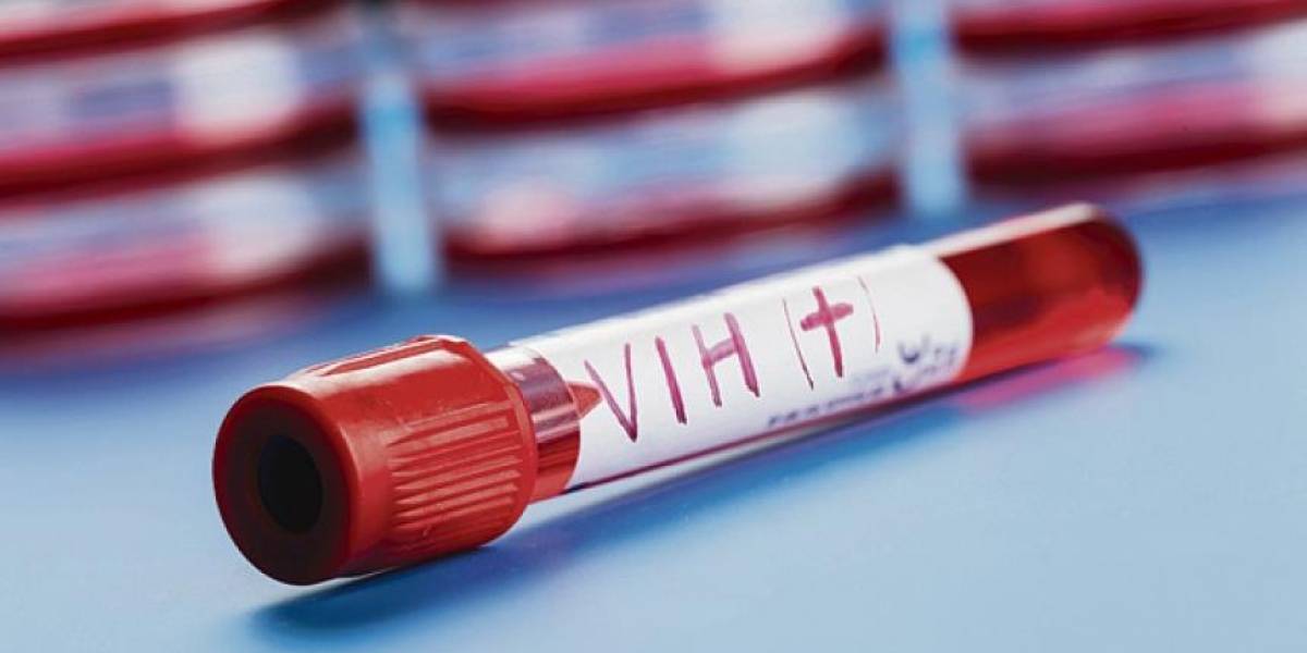 71 mil personas tiene VIH en Chile