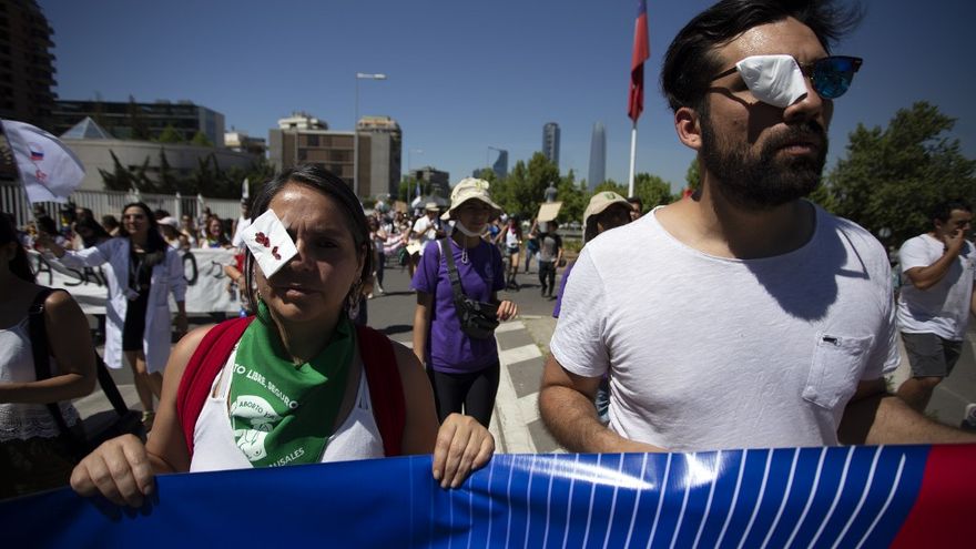 200 personas en Chile tiene lesiones oculares dentro de las movilizaciones