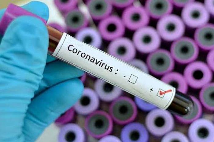 7 casos confirmados con coronavirus en el Maule